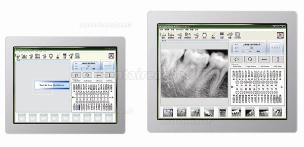 VATECH® EzSensor 1.5 capteur radio dentaire pour radiographie numérique dentaire